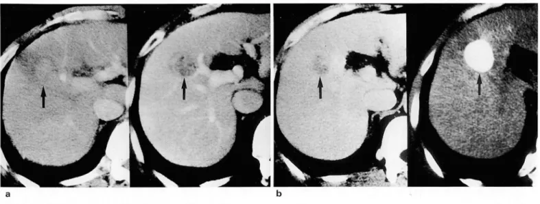 Fig.  2 .  High-Low-Low  attenuation  (21  -40mm ) 