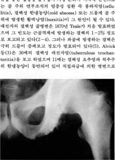 Table 1. 8ummary of Tuberculous  Osteitis  in  14  Patients 