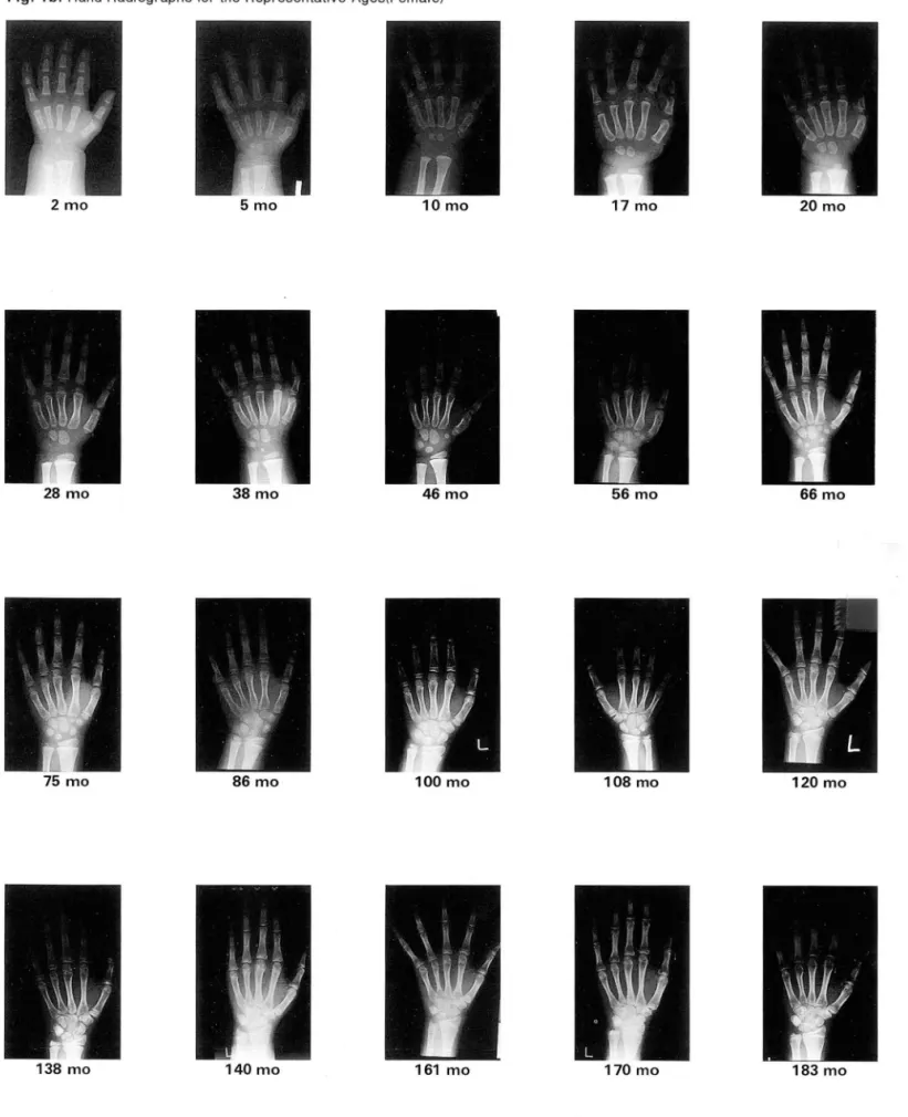 Fig.  1 b.  Hand  Radiographs  for the  Representative  Ages(Female) 