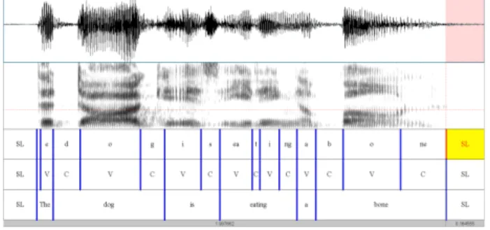 Table 5. Means (standard deviation) of rhythm metrics for ten native  speakers, twenty Chinese advanced learners and twenty beginners 