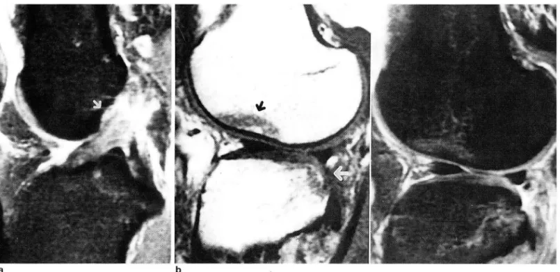 Fig.  2.  The  second  common  group  01  injury 