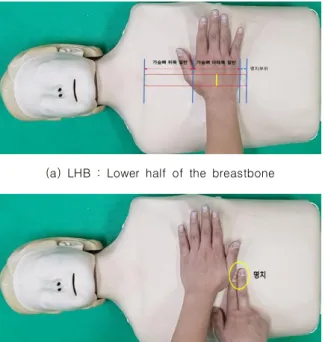 Fig.  2.  Measurement  length  of  palm 