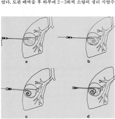 Fig.  1.  Schematic drawings 01  the  procedure 
