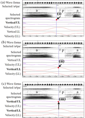 Figure 2. Vertical lower lip maxima (a) Speech rates and (b) Boundary  types. (The symbol '**' is for p<0.01.)