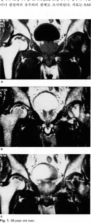Fig.  1 .  58-year old  man 