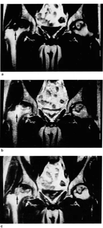 Fig.  2. 29-year  old  man. 