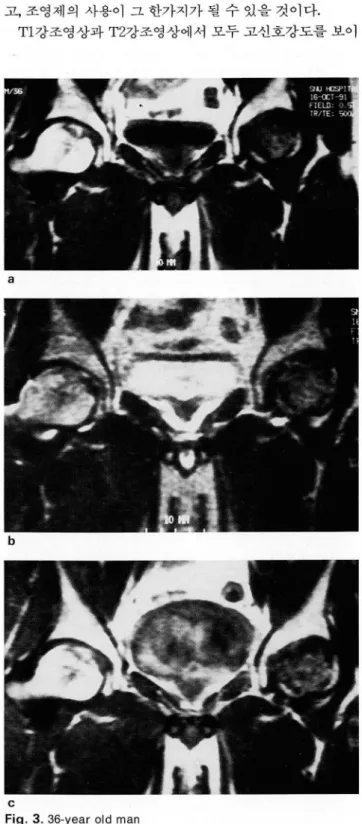 Fig.  3. 36-year old  man 