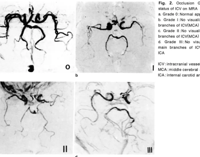 Fig .  2.  Occlusion  Grade  according  t。