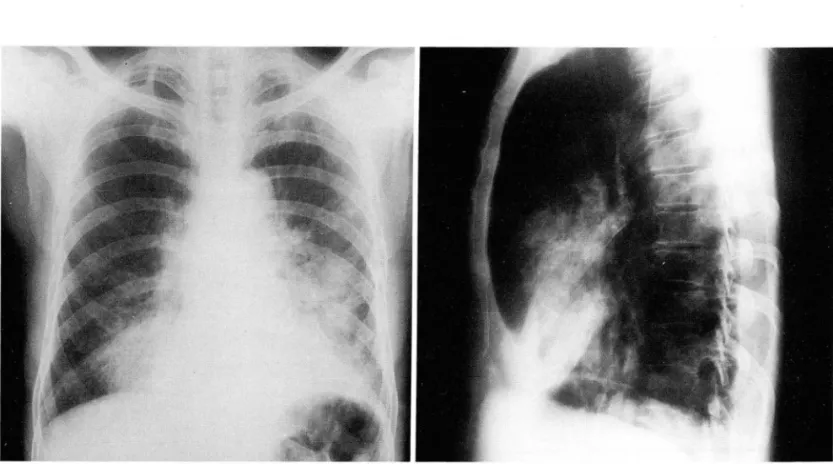 Fig.  2 .  A  73-year-old  man  was  admitted  to  the hospital  because  01  the  generalized  weekness  and  anorexia 