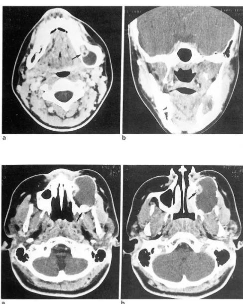 Fig.  2.  case 1 