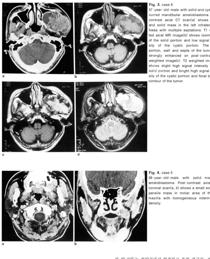 Fig.  4.  case 5 