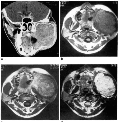 Fig.  6.  case 12 