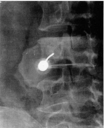 Table  1 .  Di stribution  01  Biopsy  Sites  Bi opsy Site  Long  bone  Fem ur  Humerus  No