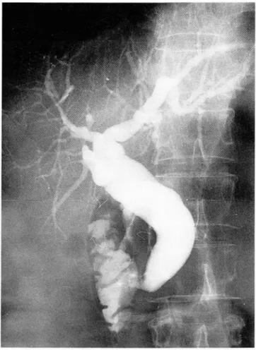 Fig .  3.  ERCP  01  case  1 