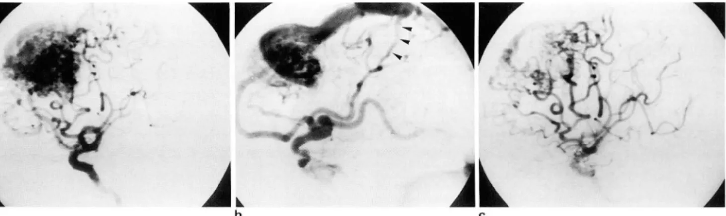 Fig  2  A  2O  year  。|g man  Wlth  sp。ntane。US 1때 