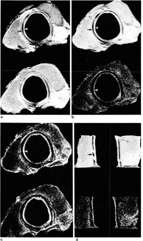 Fig.  5.  In  vito  MR  images  01  the  cada- cada-veric trachea 