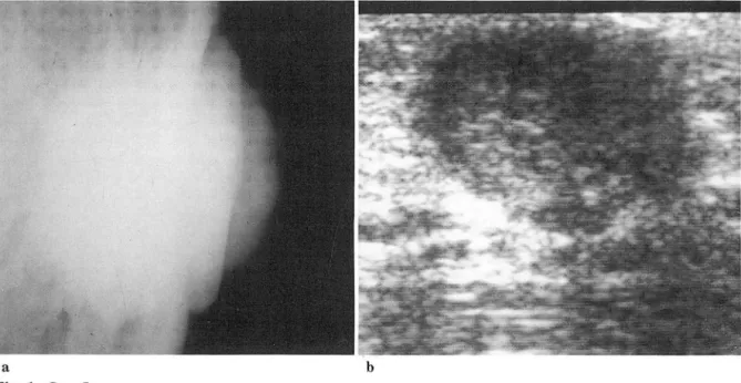 Fig.  1.  Case 1 