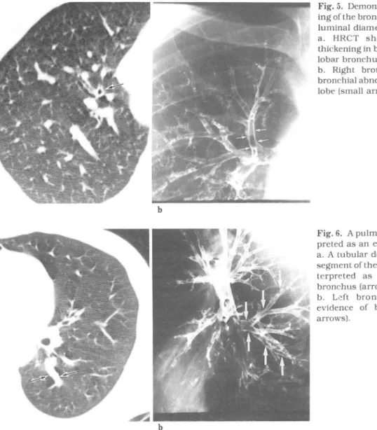 Fig. 5.  Dem onstration of the t hicken. 