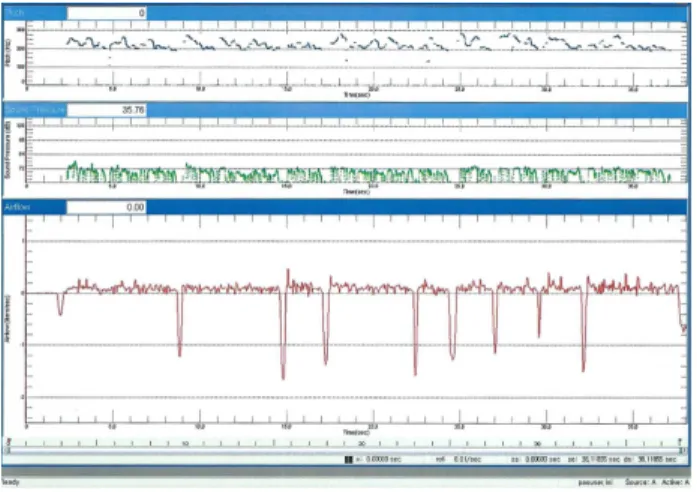 그림 1.  PAS의 ‘Running  Speech’  검사 화면(정상 발화) Figure  1.  Screen  of  ‘Running  Speech’  program  in  PAS