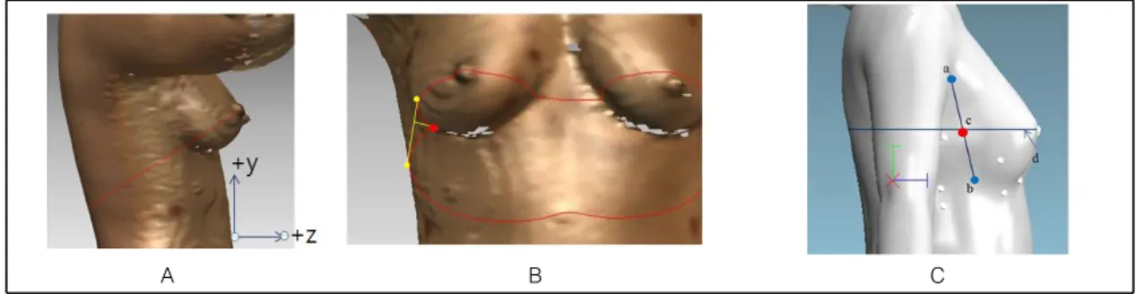Fig.  6.  Anatomical  position  of  breast  tissue