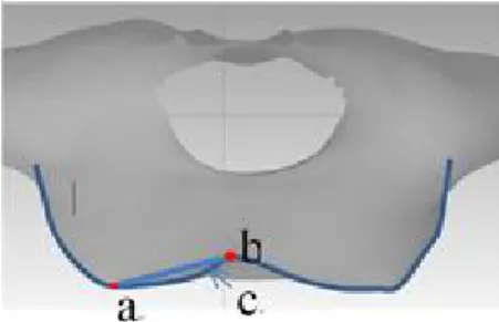 Fig.  8.  Method  for  setting  the  breast  inner  point 