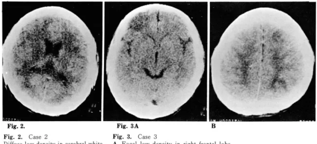 Fig,  2.  Case  2  Fig,  3,  Case  3 