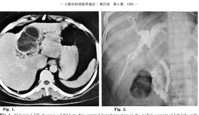 Fig.  1.  Fig.2. 