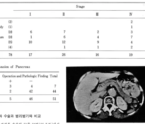 Table  4.  lnvasion  of  Pancreas 