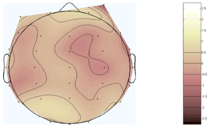 Figure  10.  Topography  obtained  from  native  speakers  of  Korean  while  they  were  hearing  heed(/hid/)  and  hid(/hɪd/)
