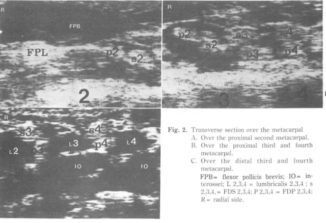 Fig. 2.  Tran sverse  section over the  ll1 etacarpal 