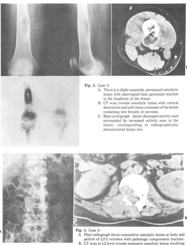 Fig. 3 .  Case  3 