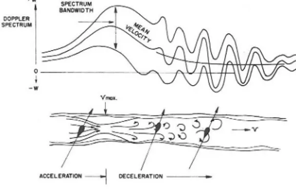 Fig.  6.  A narrowed axial segment of a blood  vessel causes  the  velocity  of  the  blood  to  accelerate  to  a  max