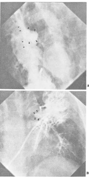 Fig 4.  6 year  old  boy . 