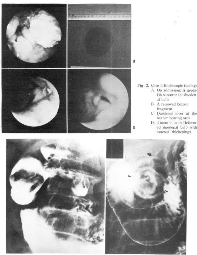 Fig. 3.  Case  11:  UGIS 