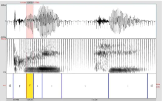 Figure  6.  The  spectrogram  and  waveform  of  onset_R_‘pretty’  produced  by_HN  (phonetic  intrusion)