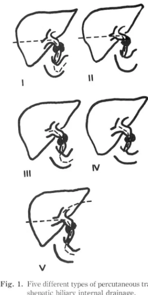 Fig.  1.  Five different types of percutaneous tran. 