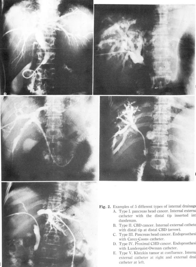 Fig.  2.  Examples  of  5  c1 ifferent types of internal  c1 rainage. 