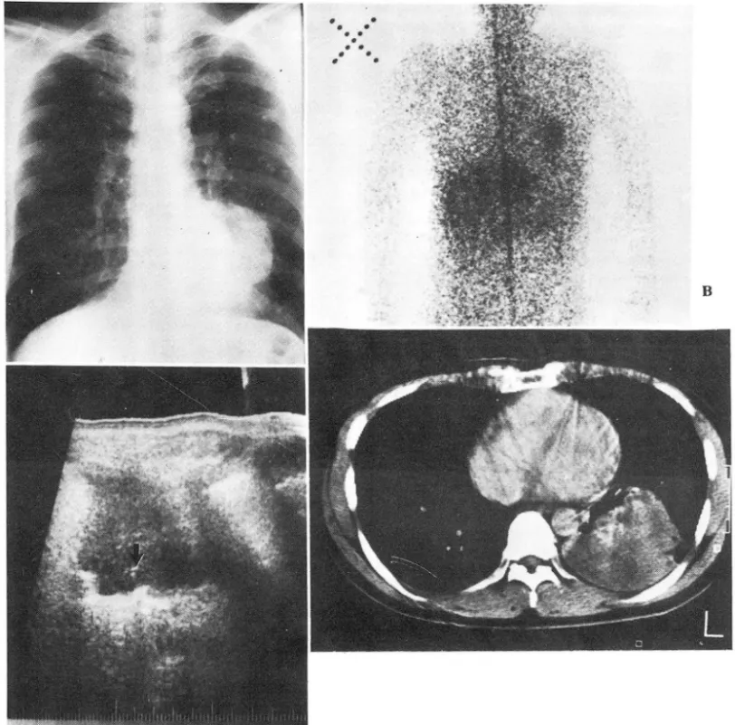 Fig. 3.  Case 3 ,  49 year  old male 