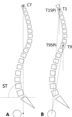 Fig. 3. The sagittal vertical axis can be greatly affected by a forward bending (A), neutral standing (B), or backward bending (C) body posture  compensating for the posture of the lower extremity joints in patients with long spinal fusion, because the com