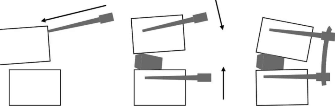 Fig. 7. Strategy to correct the slip angle of pathology, which may improve the outcomes of PT restoration