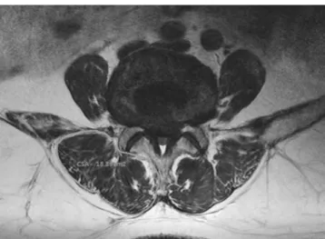 Fig. 1. Cross-sectional area (CSA)