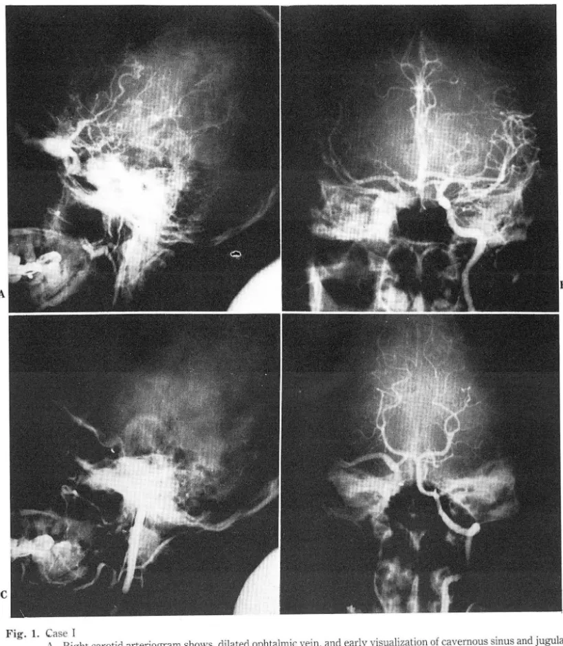 Fig.  1.  ιase  1 
