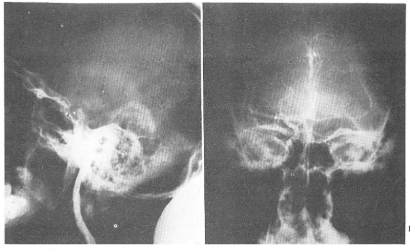 Fig.  3.  Case  III 