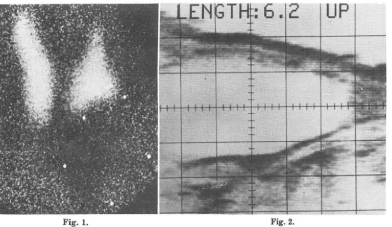 Fig.  1.  Fig.2. 