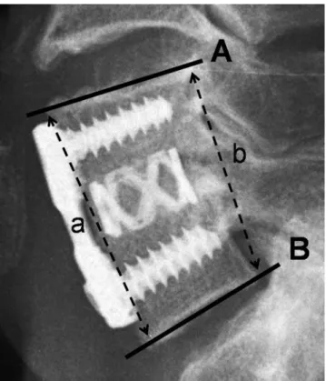 Fig. 1. Photograph of the trephine which is using tool for cancellous bone  harvest.