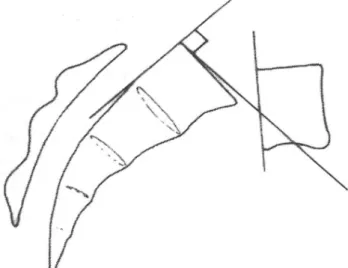 Fig. 10. Lumbar index=(A/B)×100