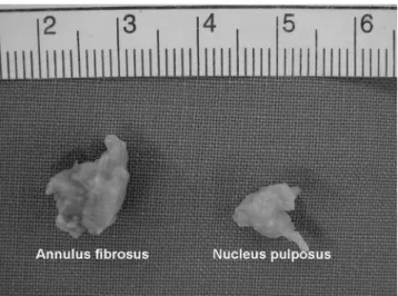 Fig. 1. Digital image of the obtained AF and NP tissue from degenerated interverte- interverte-bral disc
