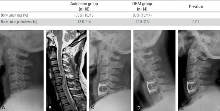Table 3. Change of neurological examination