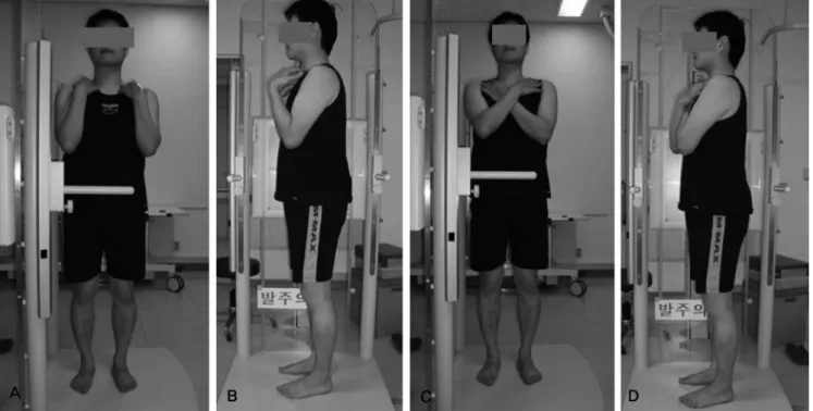 Fig. 5. Fists-on-clavicle(A, B) or cross-arm position(C, D) is recommended with extended hip and knee during taking radiographs.