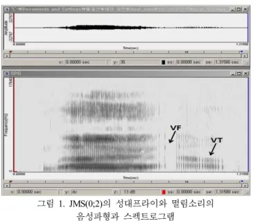 Figure  1.  Waveform  and  spectrogram  of  VF  and  VT  JMS(0;2)(VF:  vocal  fry,  VT:  vocal  tremor)